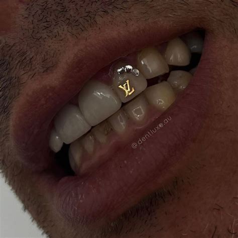 lv tooth gem|Tooth Gems Lv .